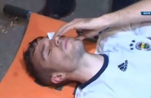 Receia-se que Van Persie possa perder a visão no olho esquerdo