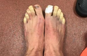 Lallana com os dedos dos pés congelados!!