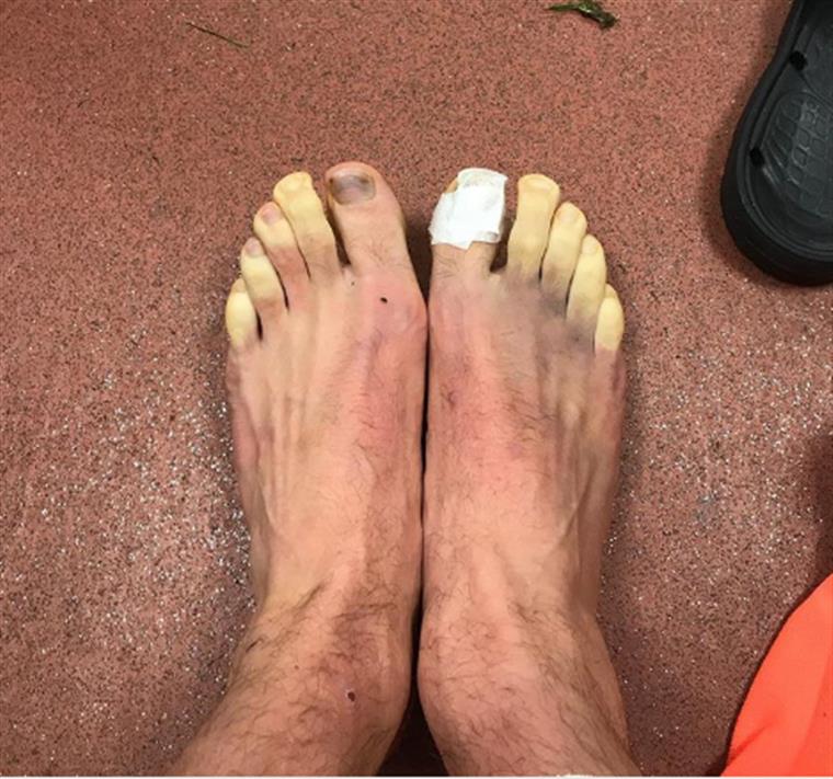 Lallana com os dedos dos pés congelados!!